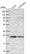 RAB5A, Member RAS Oncogene Family antibody, HPA049354, Atlas Antibodies, Western Blot image 