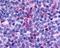 C-C chemokine receptor type 8 antibody, NLS3847, Novus Biologicals, Immunohistochemistry frozen image 