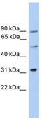 Centrosomal Protein 57 Like 1 antibody, TA331424, Origene, Western Blot image 