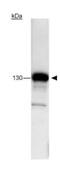 BRCA1 Interacting Protein C-Terminal Helicase 1 antibody, GTX23641, GeneTex, Western Blot image 