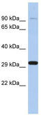 Endonuclease G, mitochondrial antibody, TA340055, Origene, Western Blot image 