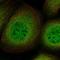 Lipid Droplet Associated Hydrolase antibody, NBP1-82135, Novus Biologicals, Immunofluorescence image 