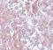 ELOVL Fatty Acid Elongase 7 antibody, PA5-20913, Invitrogen Antibodies, Immunohistochemistry paraffin image 
