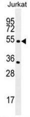 Cholinergic Receptor Nicotinic Alpha 2 Subunit antibody, AP50908PU-N, Origene, Western Blot image 