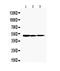 Kidney injury molecule 1 antibody, GTX12016, GeneTex, Western Blot image 