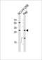 HLA class II histocompatibility antigen, DRB1-15 beta chain antibody, LS-C203667, Lifespan Biosciences, Western Blot image 