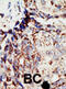 BRCA1 Associated Protein 1 antibody, abx031561, Abbexa, Immunohistochemistry paraffin image 