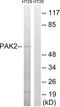 Gamma-PAK antibody, abx012932, Abbexa, Western Blot image 