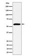 Pre-MRNA Processing Factor 4 antibody, M08225, Boster Biological Technology, Western Blot image 