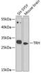 Prothyroliberin antibody, 23-510, ProSci, Western Blot image 