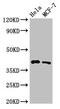 HLA class I histocompatibility antigen, B-82 alpha chain antibody, CSB-PA642773LA01HU, Cusabio, Western Blot image 