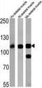ATPase Sarcoplasmic/Endoplasmic Reticulum Ca2+ Transporting 1 antibody, GTX22819, GeneTex, Western Blot image 
