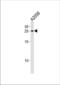 Adenine Phosphoribosyltransferase antibody, TA324753, Origene, Western Blot image 