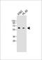 Caspase Recruitment Domain Family Member 9 antibody, M01410, Boster Biological Technology, Western Blot image 