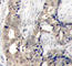 ABL Proto-Oncogene 1, Non-Receptor Tyrosine Kinase antibody, AP0303, ABclonal Technology, Immunohistochemistry paraffin image 