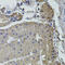 Ubiquitin Conjugating Enzyme E2 S antibody, 19-436, ProSci, Immunohistochemistry paraffin image 