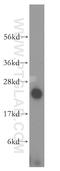 NADH:Ubiquinone Oxidoreductase Subunit B10 antibody, 15589-1-AP, Proteintech Group, Western Blot image 