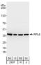 60S ribosomal protein L6 antibody, A303-585A, Bethyl Labs, Western Blot image 