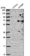 Acrosin Binding Protein antibody, NBP1-85408, Novus Biologicals, Western Blot image 