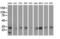 Peroxisomal trans-2-enoyl-CoA reductase antibody, M10430, Boster Biological Technology, Western Blot image 