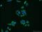Staphylococcal Nuclease And Tudor Domain Containing 1 antibody, 10760-1-AP, Proteintech Group, Immunofluorescence image 