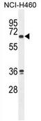 Zinc Finger Protein 813 antibody, AP54724PU-N, Origene, Western Blot image 