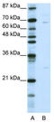 Kelch Like Family Member 13 antibody, TA337273, Origene, Western Blot image 