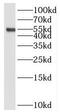 STEAP3 Metalloreductase antibody, FNab08318, FineTest, Western Blot image 