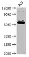 OMA1 Zinc Metallopeptidase antibody, CSB-PA856923LA01HU, Cusabio, Western Blot image 