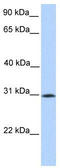 SLG antibody, TA342079, Origene, Western Blot image 