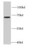 Heparanase 2 (Inactive) antibody, FNab04006, FineTest, Western Blot image 