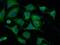 Voltage Dependent Anion Channel 1 antibody, 10866-1-AP, Proteintech Group, Immunofluorescence image 