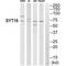Synaptotagmin 16 antibody, A13306, Boster Biological Technology, Western Blot image 