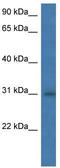 HLA class II histocompatibility antigen, DM alpha chain antibody, TA343137, Origene, Western Blot image 