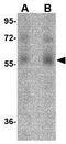 ORAI Calcium Release-Activated Calcium Modulator 1 antibody, GTX17287, GeneTex, Western Blot image 