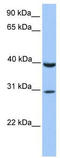 TIP27 antibody, TA345603, Origene, Western Blot image 