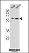 Homeobox A10 antibody, 55-119, ProSci, Western Blot image 