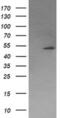 Protein Phosphatase, Mg2+/Mn2+ Dependent 1B antibody, MA5-25538, Invitrogen Antibodies, Western Blot image 