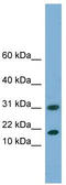 Eukaryotic Translation Initiation Factor 5A2 antibody, TA344786, Origene, Western Blot image 