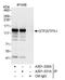 SPIN antibody, A301-330A, Bethyl Labs, Immunoprecipitation image 