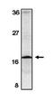 Survivin antibody, orb108734, Biorbyt, Western Blot image 