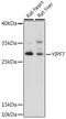 Protein YIPF7 antibody, 16-481, ProSci, Western Blot image 