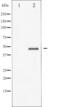 Glycogen Synthase Kinase 3 Beta antibody, OAAJ02835, Aviva Systems Biology, Western Blot image 