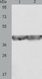 Aldolase, Fructose-Bisphosphate A antibody, TA321043, Origene, Western Blot image 