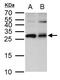 ETHE1 Persulfide Dioxygenase antibody, GTX109095, GeneTex, Western Blot image 