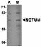 Notum, Palmitoleoyl-Protein Carboxylesterase antibody, orb75249, Biorbyt, Western Blot image 