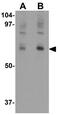 NUMB Endocytic Adaptor Protein antibody, GTX31439, GeneTex, Western Blot image 