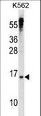 MAX Dimerization Protein 3 antibody, LS-C164691, Lifespan Biosciences, Western Blot image 