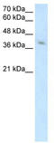MHC Class I Polypeptide-Related Sequence A antibody, TA334664, Origene, Western Blot image 