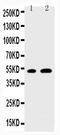 Early Growth Response 2 antibody, PA2178, Boster Biological Technology, Western Blot image 